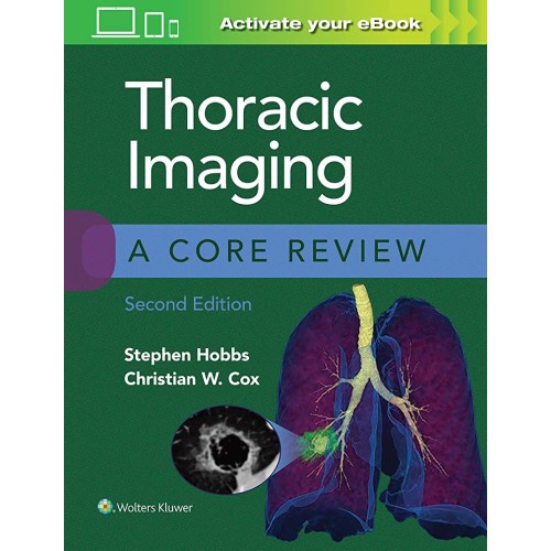 Thoracic Imaging A Core Review 2Ed (Pb 2021)