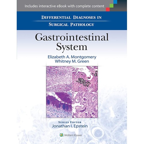 Differential Diagnoses In Surgical Pathology ...