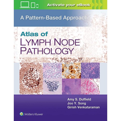 Atlas Of Lymph Node Pathology A Pattern Based...