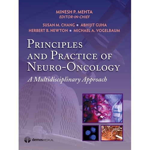 Principles And Practice Of Neuro Oncology A M...