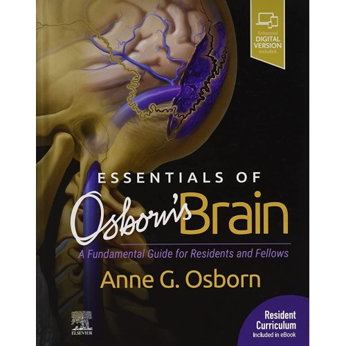 Essentials Of Osborns Brain A Fundamental Gui...