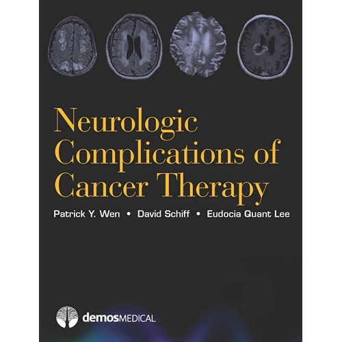 Neurologic Complications Of Cancer Therapy (H...