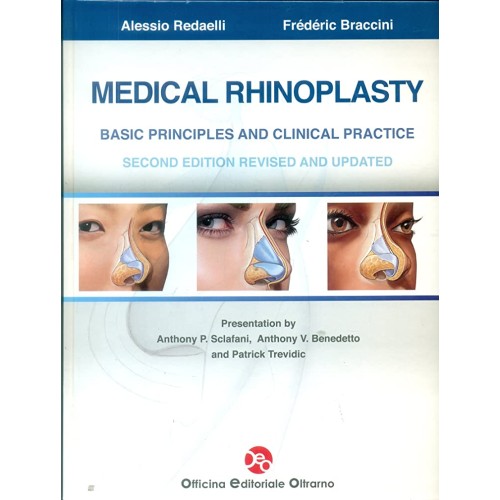 Medical Rhinoplasty Basic Principles And Clin...