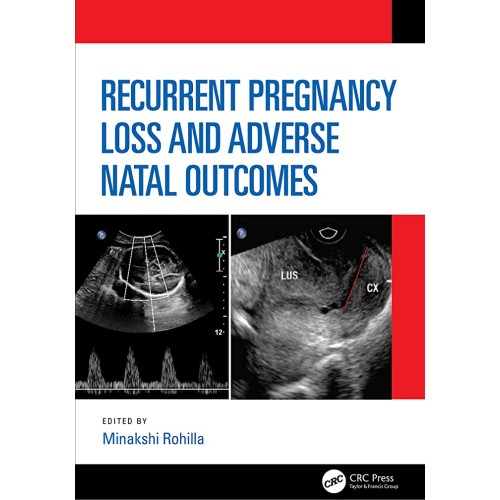 Recurrent Pregnancy Loss And Adverse Natal Ou...