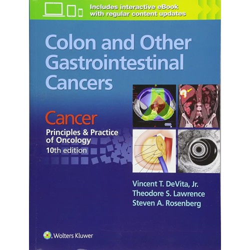 Colon And Other Gastrointestinal Cancers Canc...