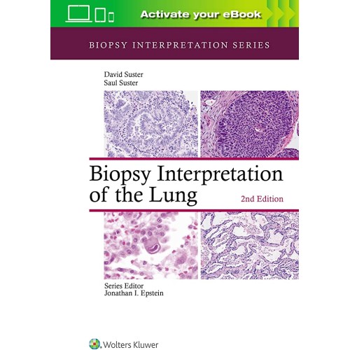 Biopsy Interpretation Of The Lung 2Ed (Hb 202...