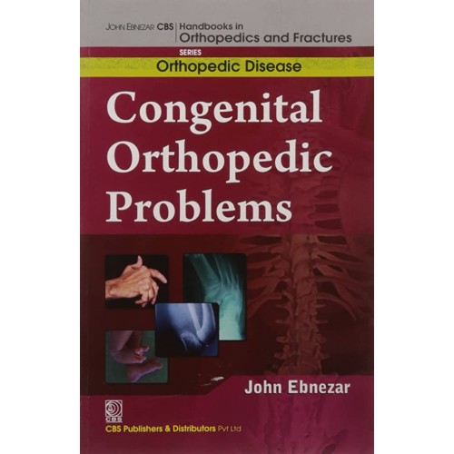 Congenital Orthopedic Problems (Handbooks In ...