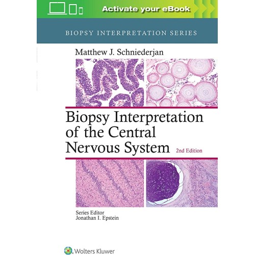 Biopsy Interpretation Of The Central Nervous ...