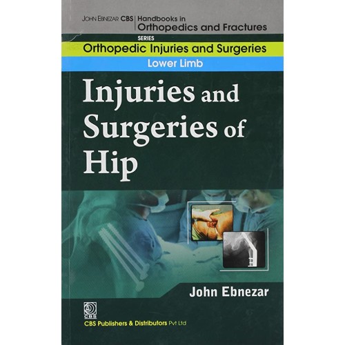 Injuries And Surgeries Of Forearm (Handbooks ...