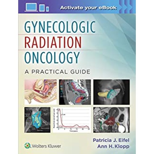 Gynecologic Radiation Oncology A Practical Gu...