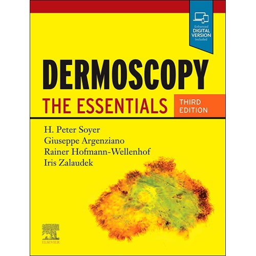 Dermoscopy The Essentials 3Ed (Pb 2020)