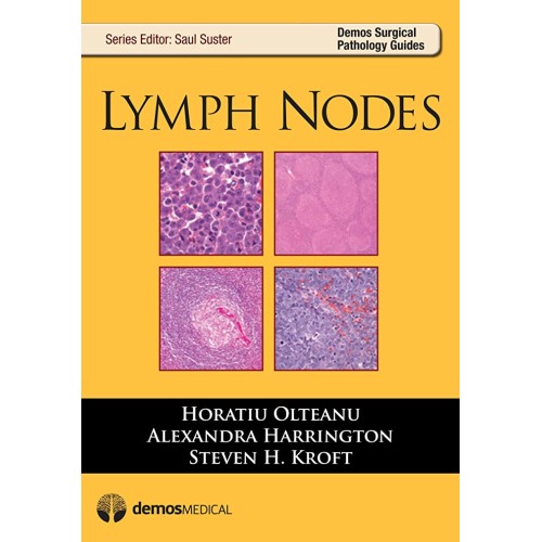 Lymph Nodes (Pb 2013) 