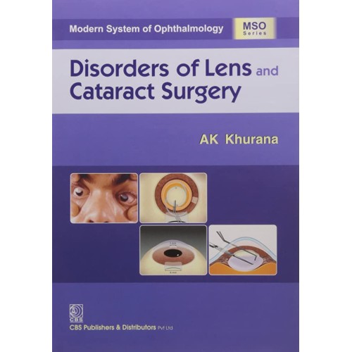 Disorders Of Lens And Cataract Surgery (Mso S...