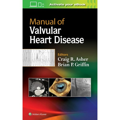 Manual Of Valvular Heart Disease (Pb 2018) 