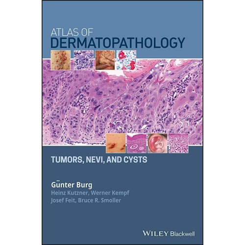 Atlas Of Dermatopathology Tumors Nevi And Cys...