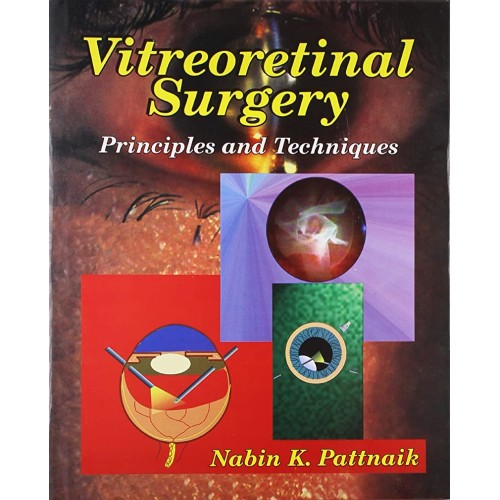 Vitreoretinal Surgery Principles And Techniqu...