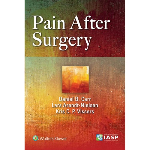 Pain After Surgery (Pb 2019) 