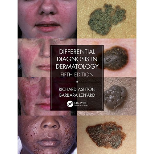 Differential Diagnosis In Dermatology 5Ed (Pb...