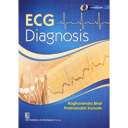 Ecg Diagnosis (Pb 2022) 