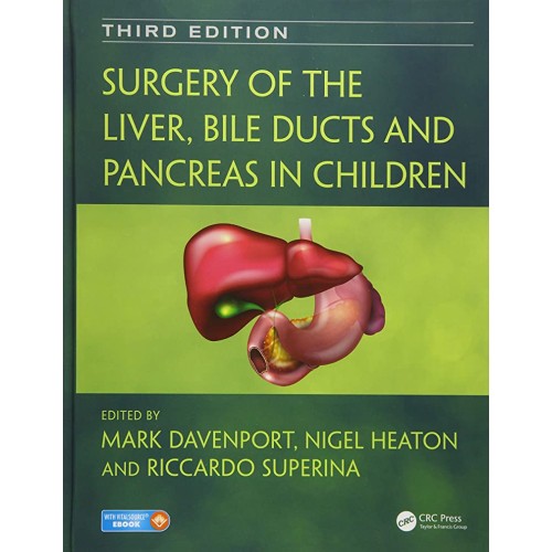 Surgery Of The Liver Bile Ducts And Pancreas ...