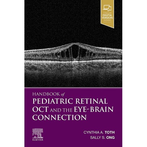 Handbook Of Pediatric Retinal Oct And The Eye...