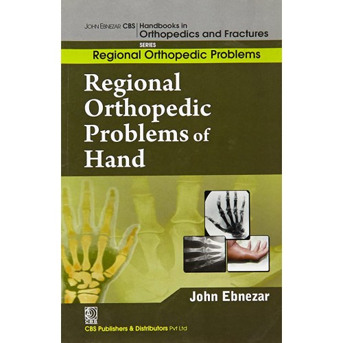 Regional Orthopedic Problems Of Hand (Handboo...