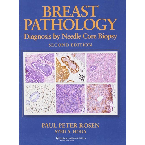 Breast Pathology Diagnosis By Needle Core Bio...