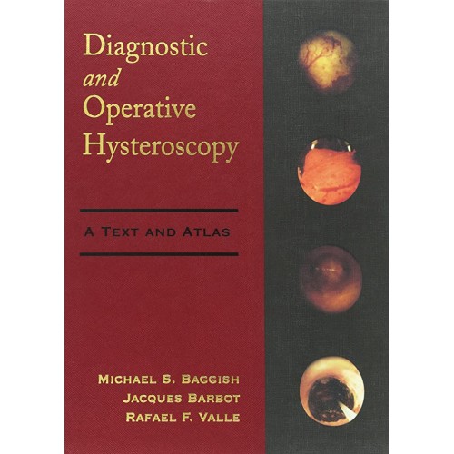 Diagnostic And Operative Hysteroscopy A Text ...