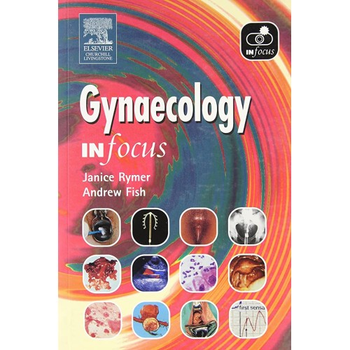 Gynaecology In Focus 