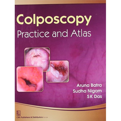 Colposcopy Practice And Atlas (Hb-2014) 