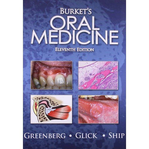 Burket'S Oral Medicine, 11E  (Sie) 