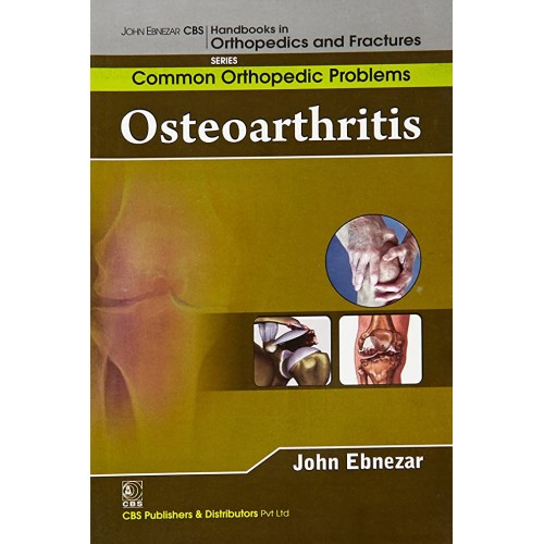 Osteoarthritis (Handbooks In Orthopedics And ...