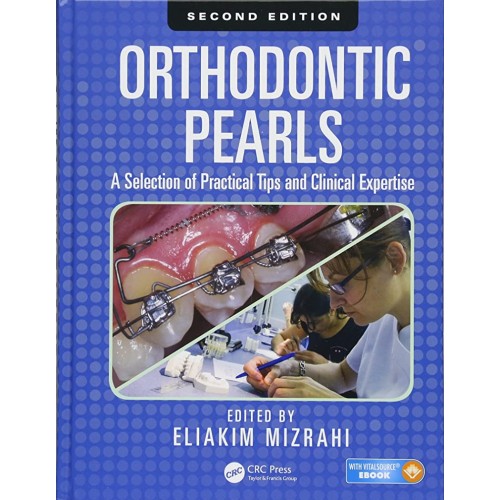 Orthodontic Pearls  A Selection Of Practical ...