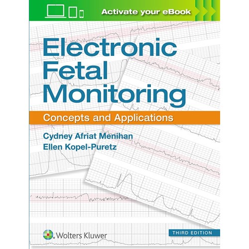 Electronic Fetal Monitoring Concepts And Appl...