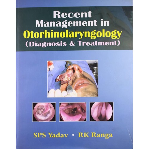 Recent Management In Otorhinolaryngology: Dia...