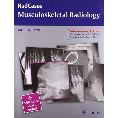 Radcases: Musculoskeletal Radiology (Ie) 