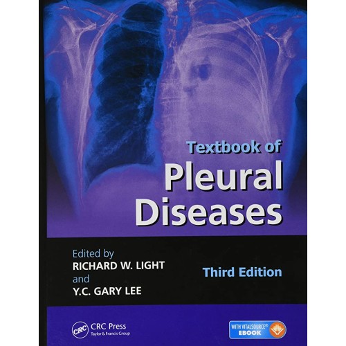 Textbook Of Pleural Diseases 3Ed (Hb 2016) 