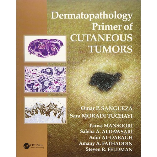 Dermatopathology Primer Of Cutaneous Tumors (...