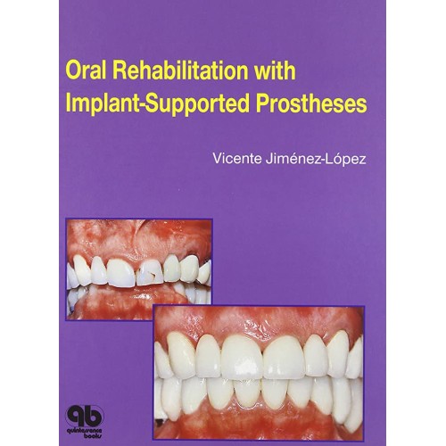 Oral Rehabilitation With Implant Supported Pr...