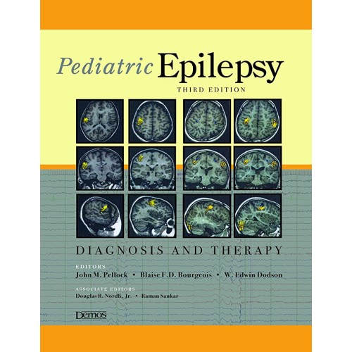 Pediatric Epilepsy Diagnosis And Therapy 3Ed ...