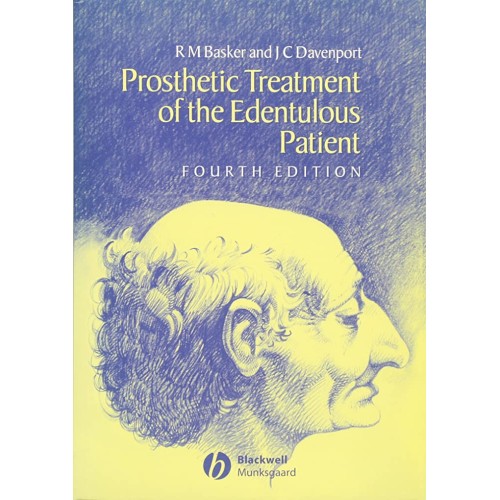 Prosthetic Treatment Of The Edentulous Patien...