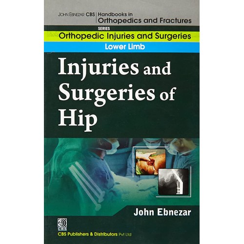 Injuries And Surgeries Of Hip (Handbooks In O...