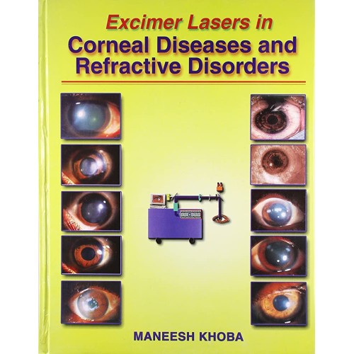 Excimer Lasers In Corneal Diseases And Refrac...