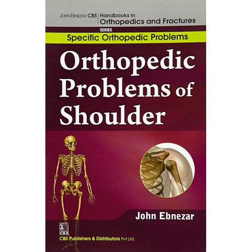 Orthopedic Problems Of Shoulder (Handbooks In...