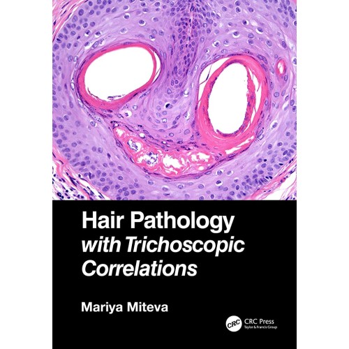 Hair Pathology With Trichoscopic Correlations...