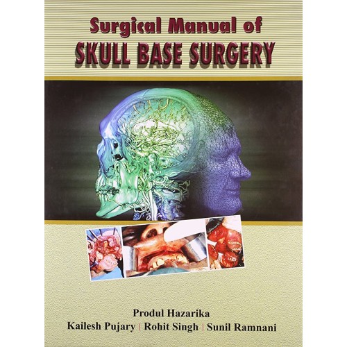 Surgical Manual Of Skull Base Surgery 