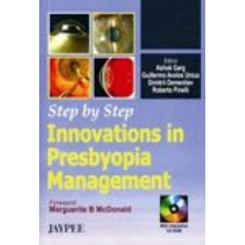 STEP BY STEP INNOVATIONS IN PRESBYOPIA MANAGE...