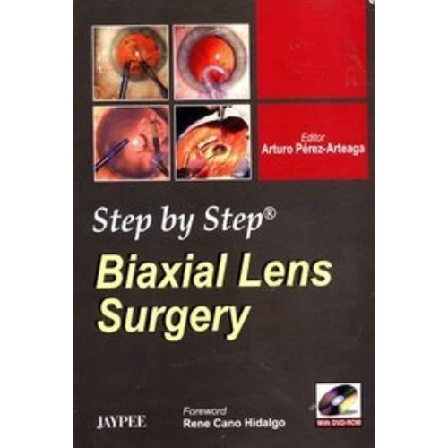 STEP BY STEP BIAXIAL LENS SURGERY WITH DVD-RO...