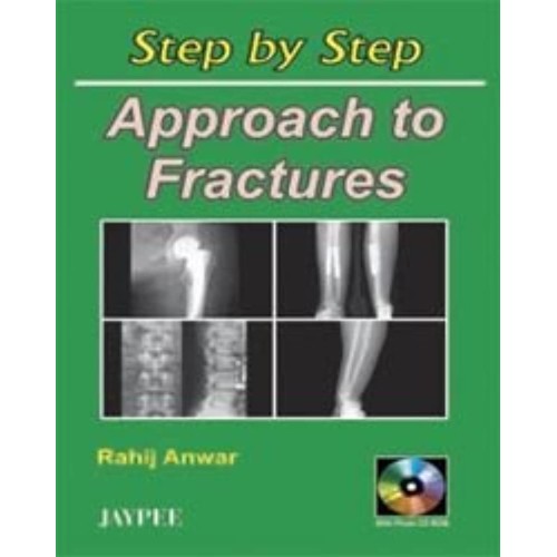 STEP BY STEP APPROACH TO FRACTURES WITH CD-RO...