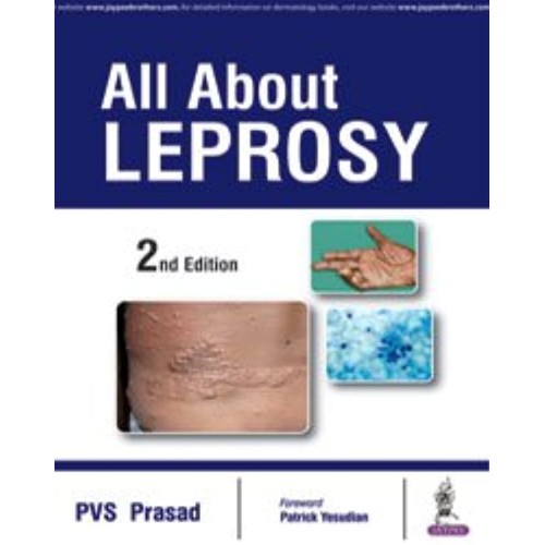 ALL ABOUT LEPROSY